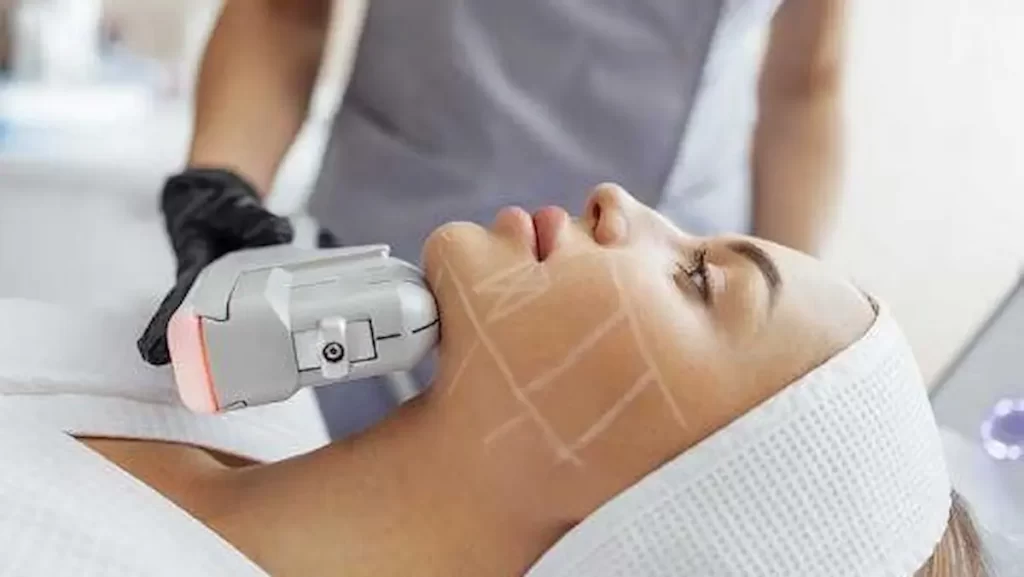 HIFU treatment process at Alora Skin Clinic in Scarborough
