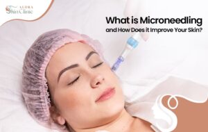 What is microneedling