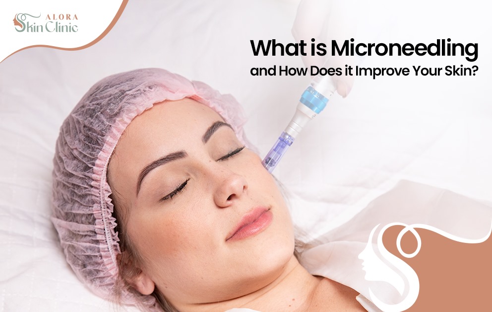 What is microneedling