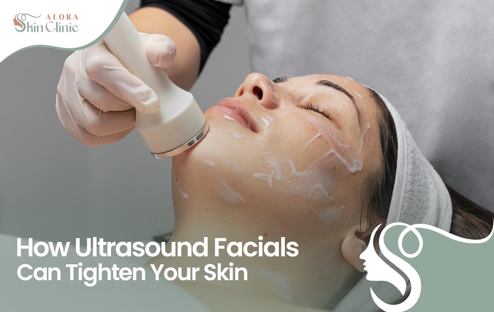 ultrasound skin tightening