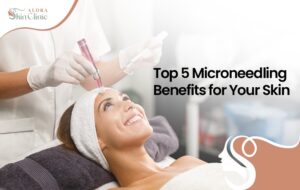 Microneedling benefits