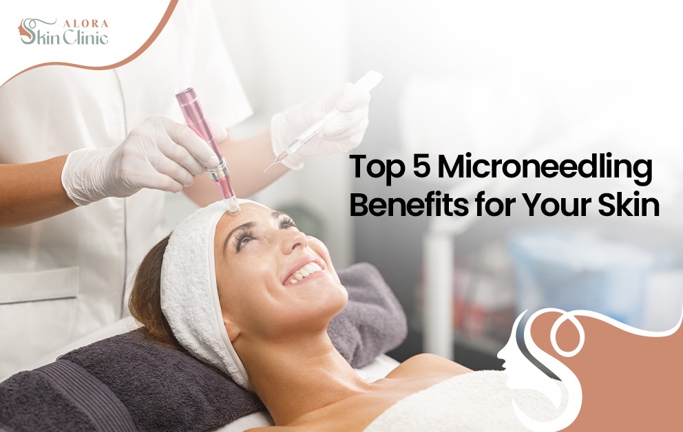 Microneedling benefits