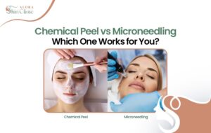 chemical peel vs microneedling