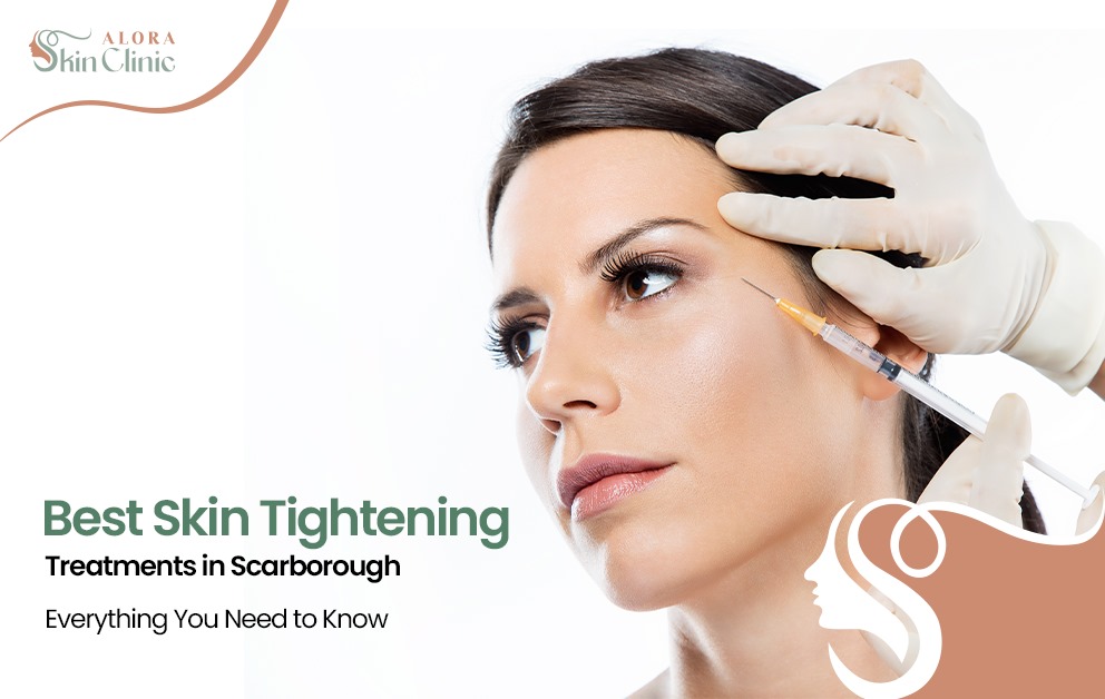 skin tightening Scarborough