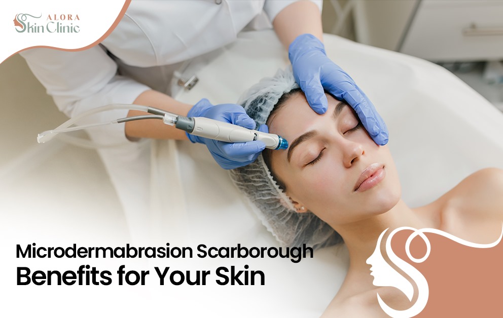 Microdermabrasion Scarborough