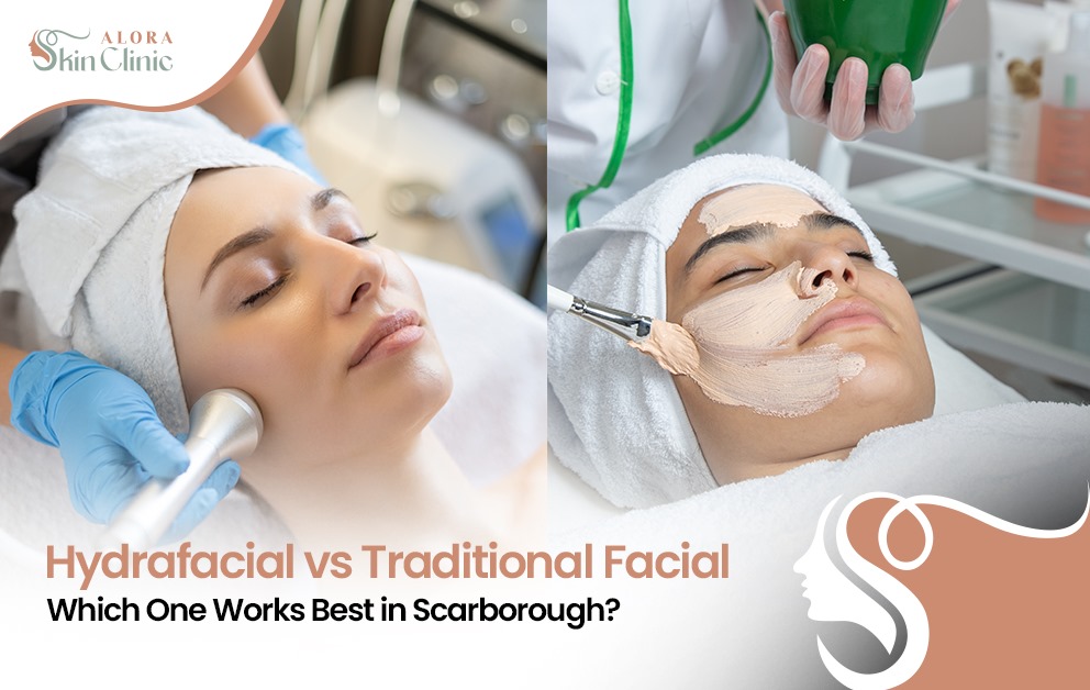 hydrafacial Scarborough