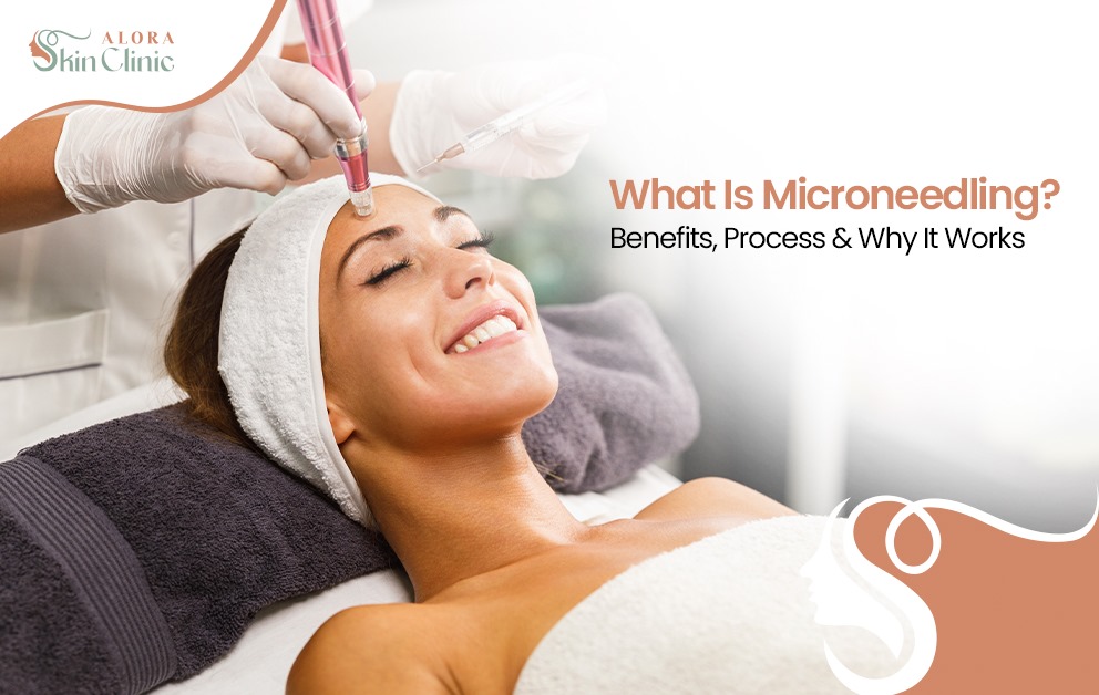 what is microneedling