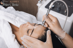 microneedling pre and post care timeline