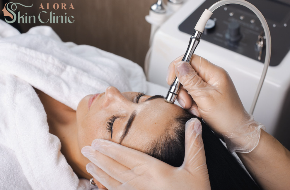 microneedling pre and post care timeline