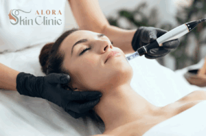 microneedling hyperpigmentation treatment