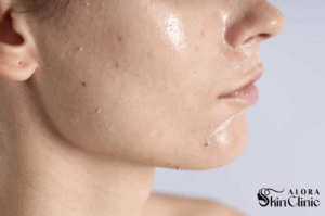 Skin hydration consultation at Alora Skin Clinic Scarborough