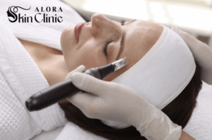 Medical microneedling treatment Scarborough clinic