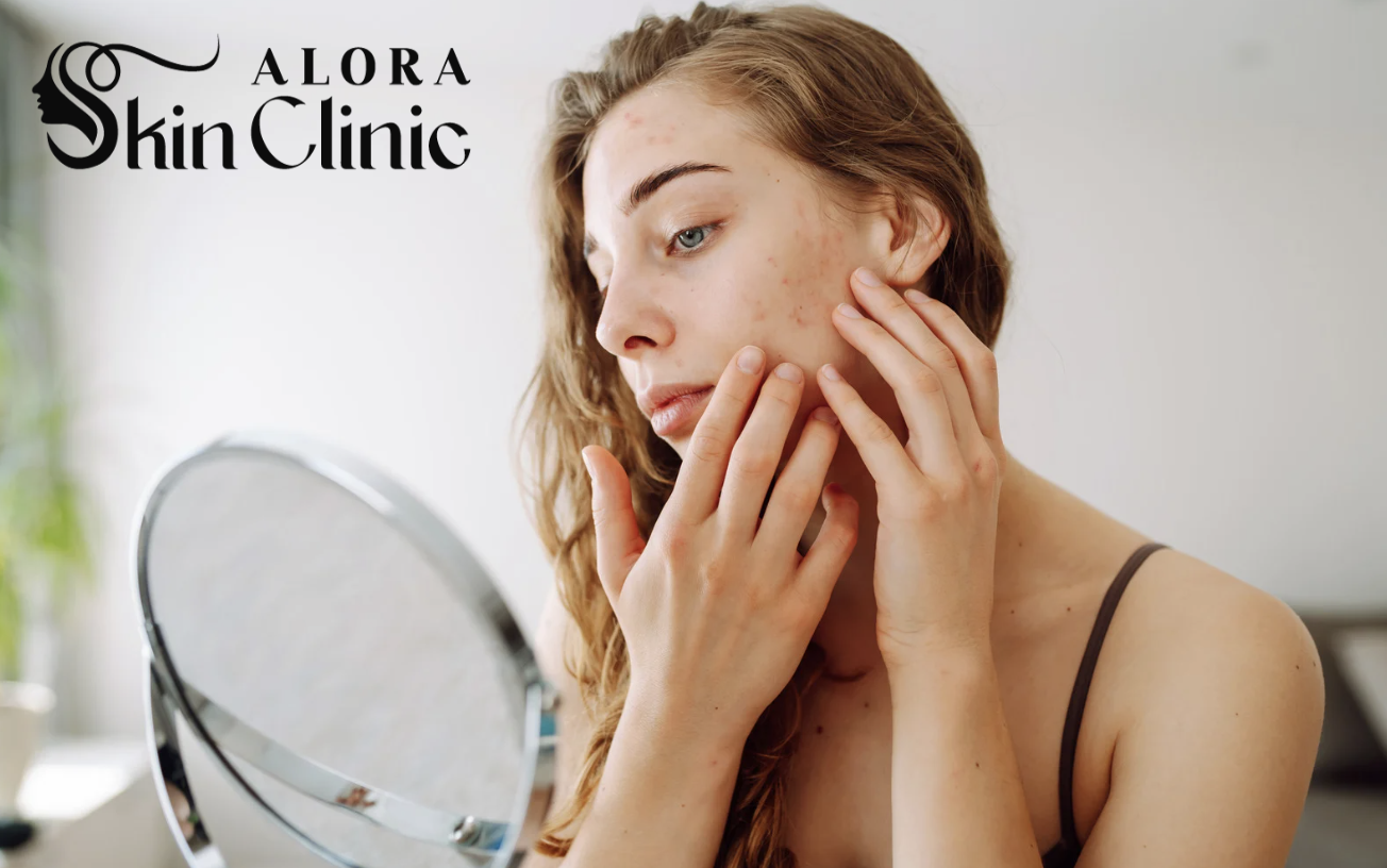 Professional facials in Scarborough for dry and dehydrated skin at Alora Skin Clinic