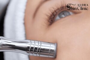 Microdermabrasion treatment at Alora Skin Clinic in Scarborough