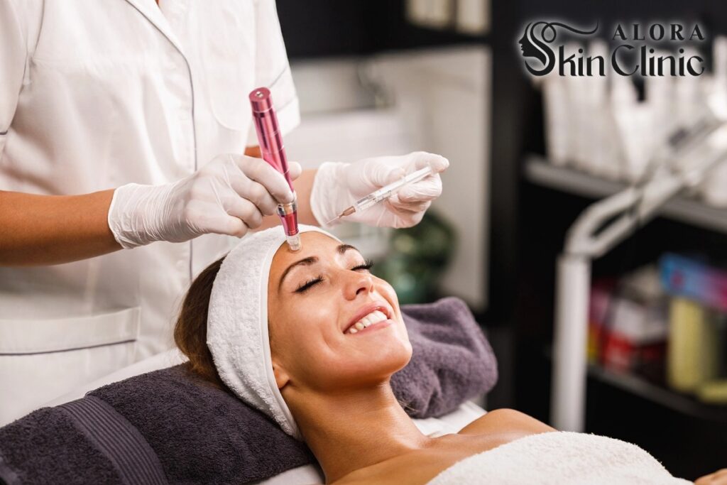 Microneedling treatment for acne scars at Alora Skin Clinic in Scarborough
