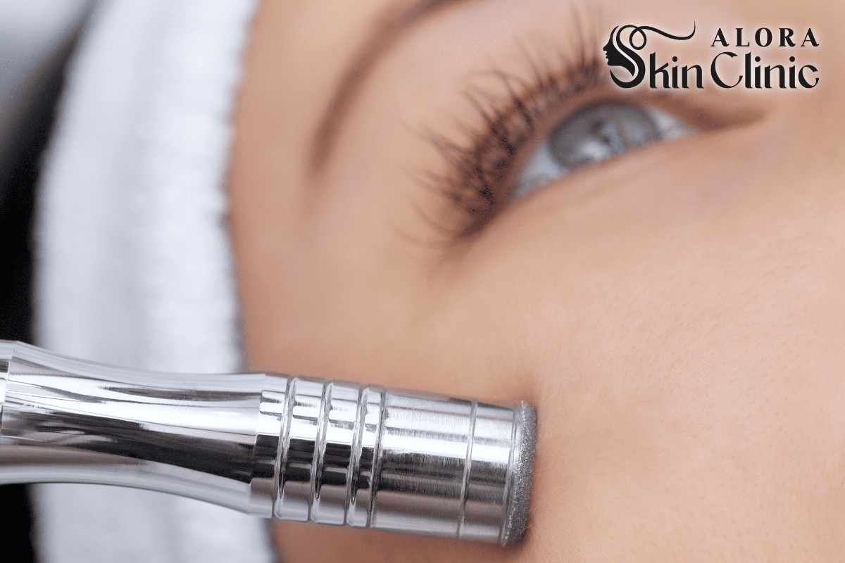 Close-up of professional skin-resurfacing care for smoother texture at Alora Skin Clinic in Scarborough
