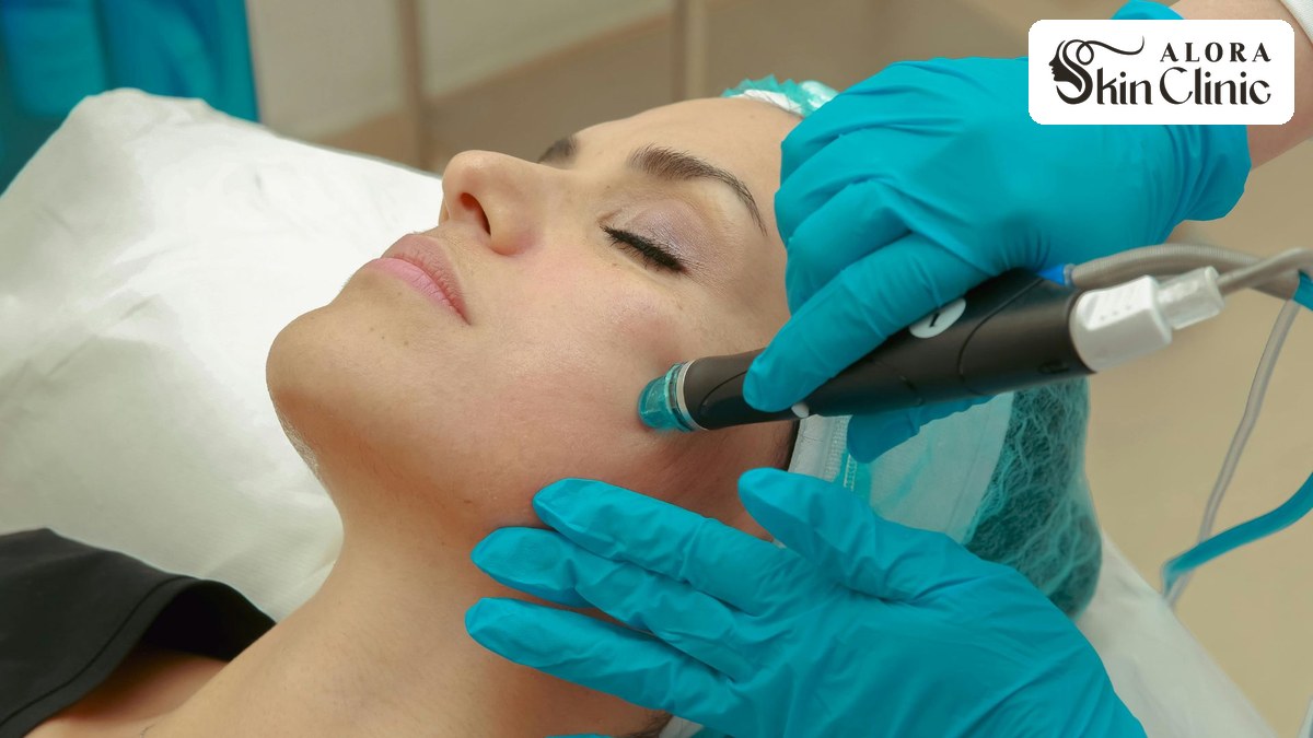 HydraFacial device treatment on a client's face at Alora Skin Clinic in Scarborough