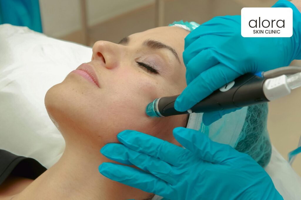 HydraFacial treatment in progress at Alora Skin Clinic in Scarborough