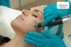 HydraFacial treatment in progress at Alora Skin Clinic in Scarborough