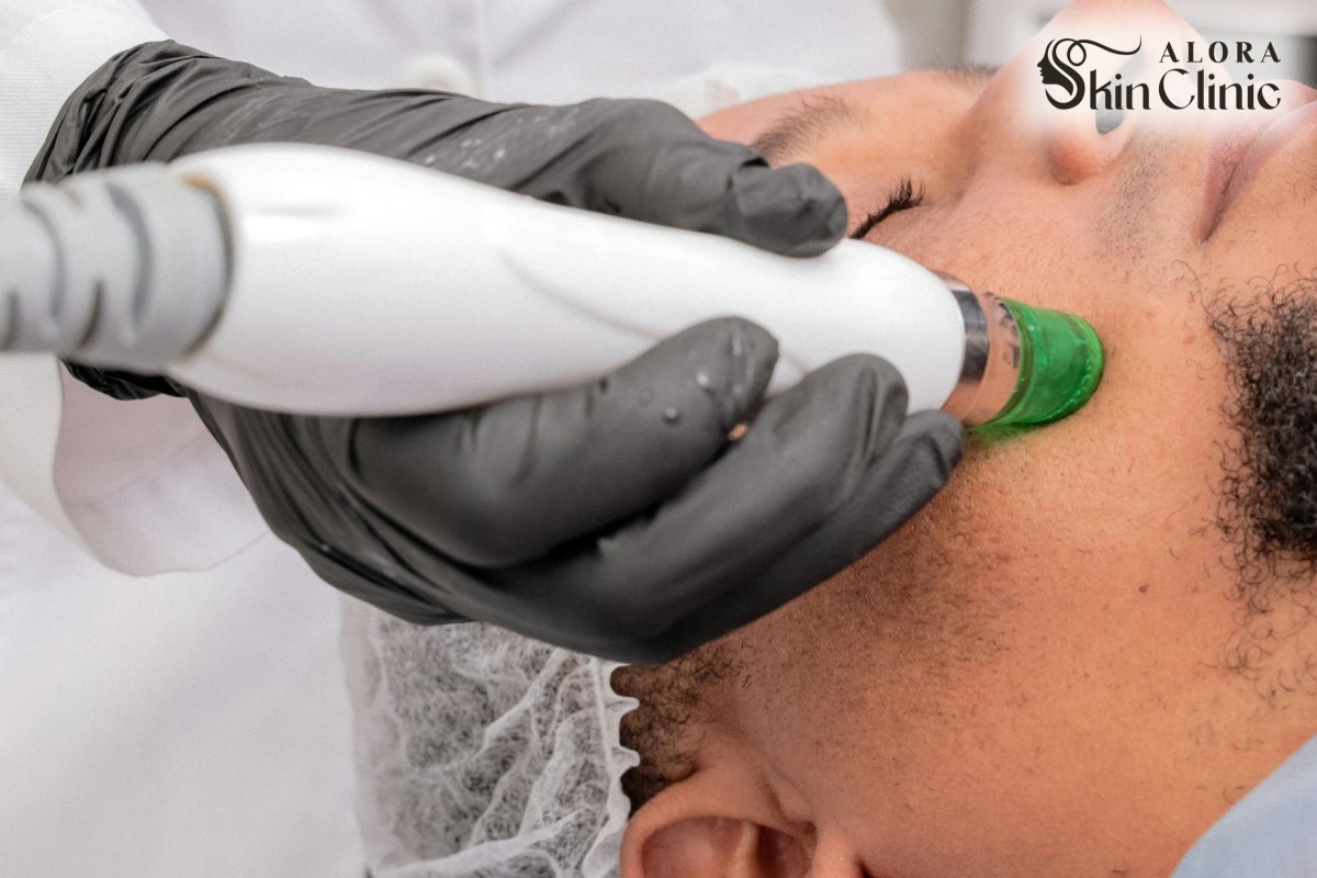 A man receiving laser hair removal on his face, showing treatment suitable for all skin tones at Alora Skin Clinic