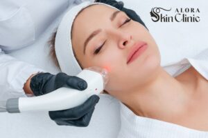 Client having a calm, non-invasive skin treatment at Alora Skin Clinic in Scarborough during the summer