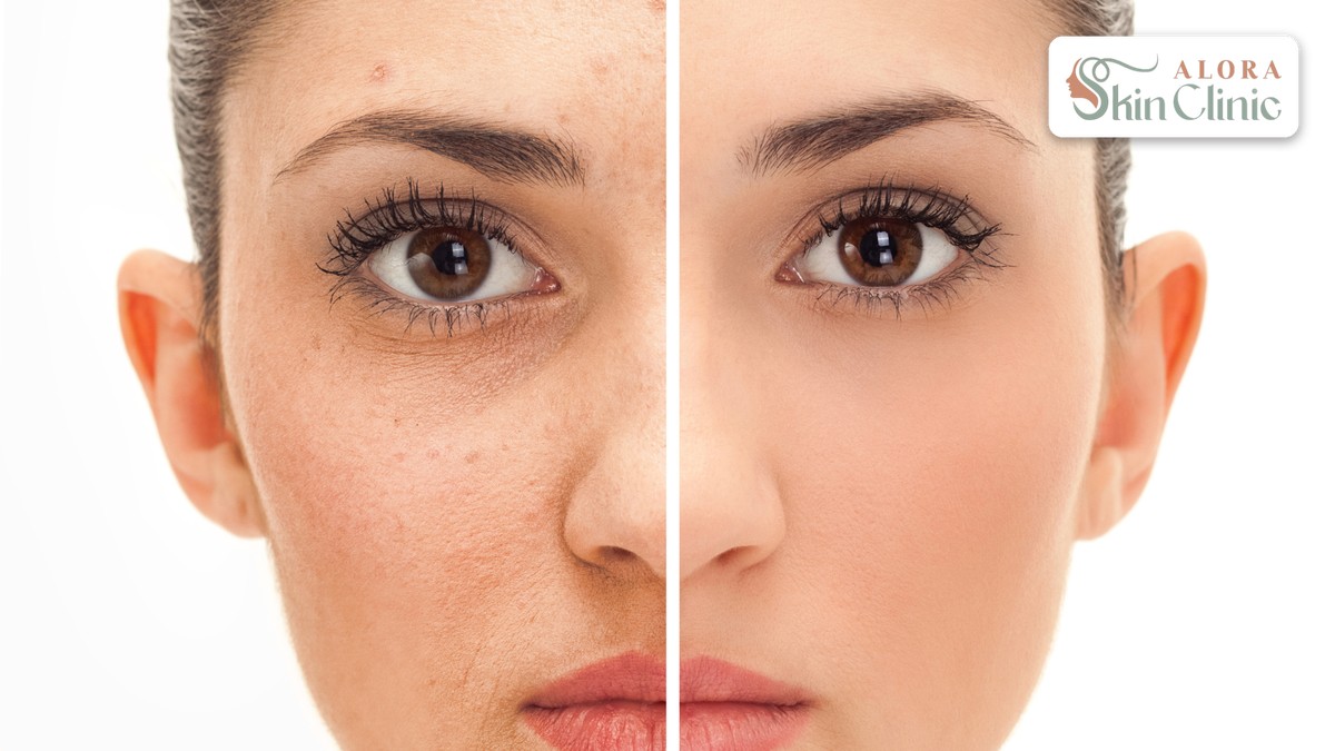 Illustration of uneven skin tone beside clearer, more even skin tone, showing what pigmentation care aims to improve