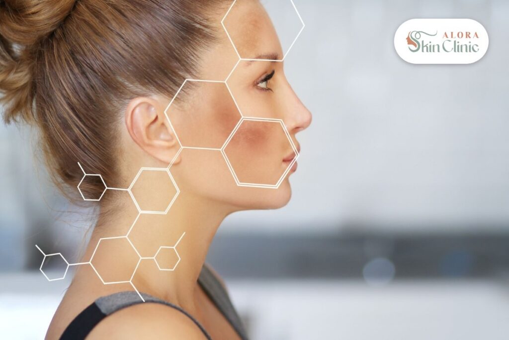 Woman in Scarborough with facial sun damage and sun spots on her cheek