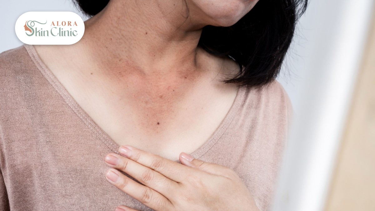 Sun damage and sun spots on a womans neck and chest