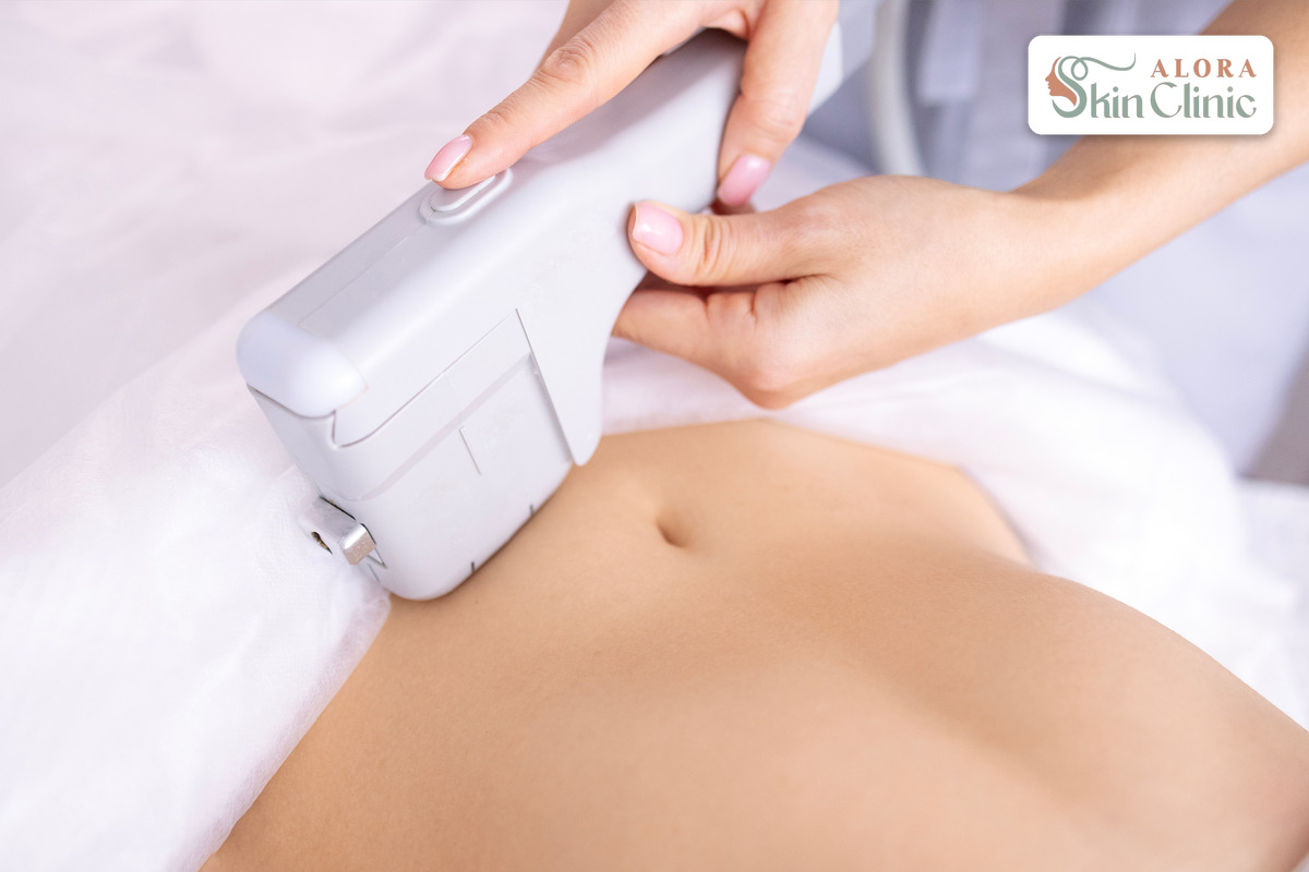 HIFU ultrasound treatment being performed on a woman at Alora Skin Clinic in Scarborough