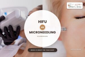 HIFU versus microneedling comparison at Alora Skin Clinic in Scarborough