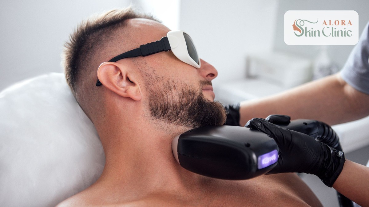 Men's laser hair removal on the beard and neck at Alora Skin Clinic in Scarborough