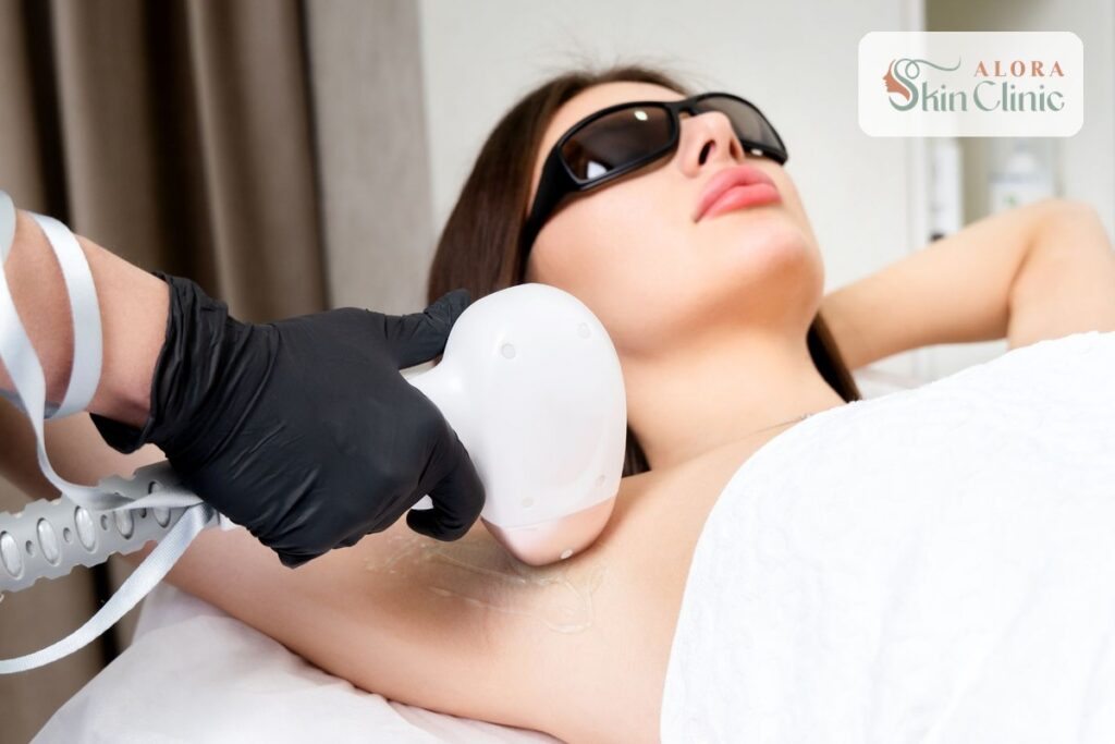 Laser hair removal underarm treatment at Alora Skin Clinic in Scarborough