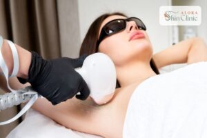 Laser hair removal underarm treatment at Alora Skin Clinic in Scarborough