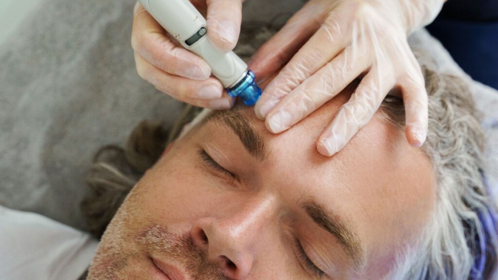 Man receiving a facial treatment on his forehead at Alora Skin Clinic in Scarborough