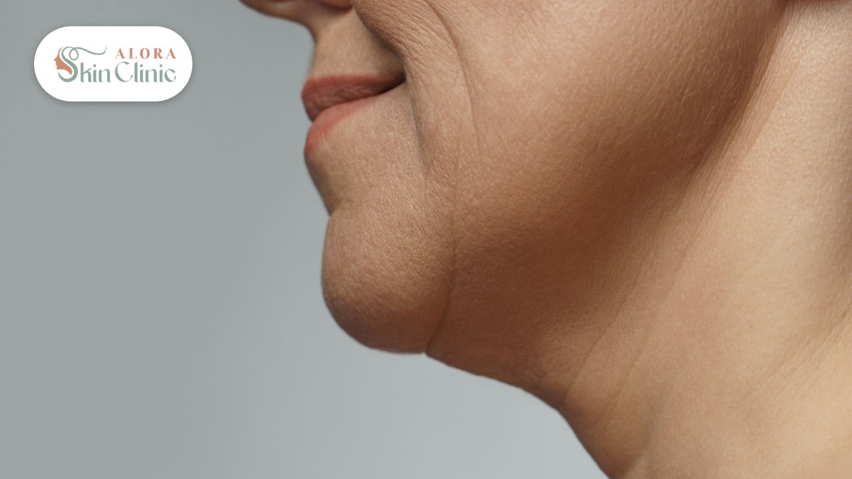 Profile view of loose skin and fullness under the chin and jawline